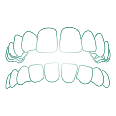 Aparelhos Ortodonticos